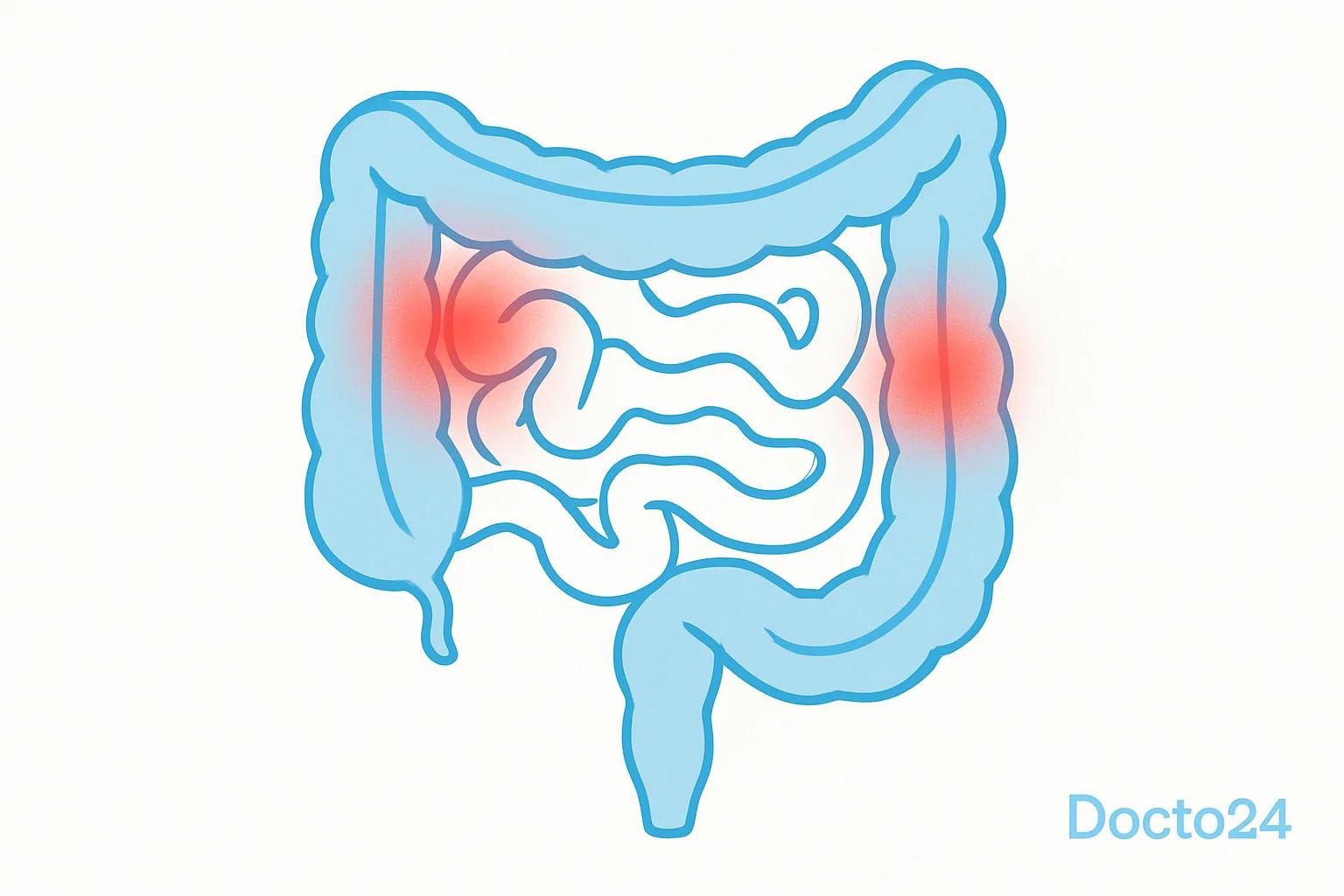 Inflammatory bowel disease — medical cannabis evaluation